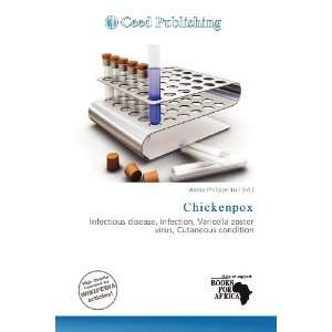  Chickenpox (9786200702586) Aaron Philippe Toll Books