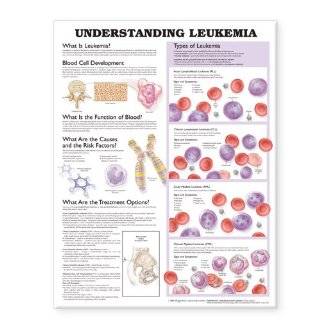  Understanding Leukemia Anatomical Chart: Explore similar 
