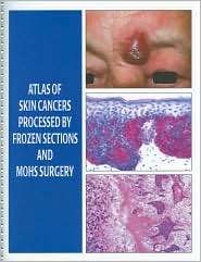 Atlas of Skin Cancers Processed by Frozen Sections and Mohs Surgery 